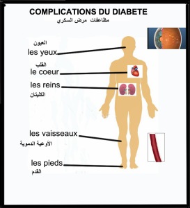 COMPLICATIONS D DIABETE COMPLETES