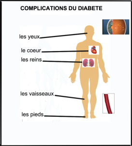 COMPLICATIONS D DIABETE FINI