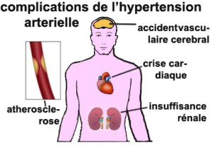 HTA complications4