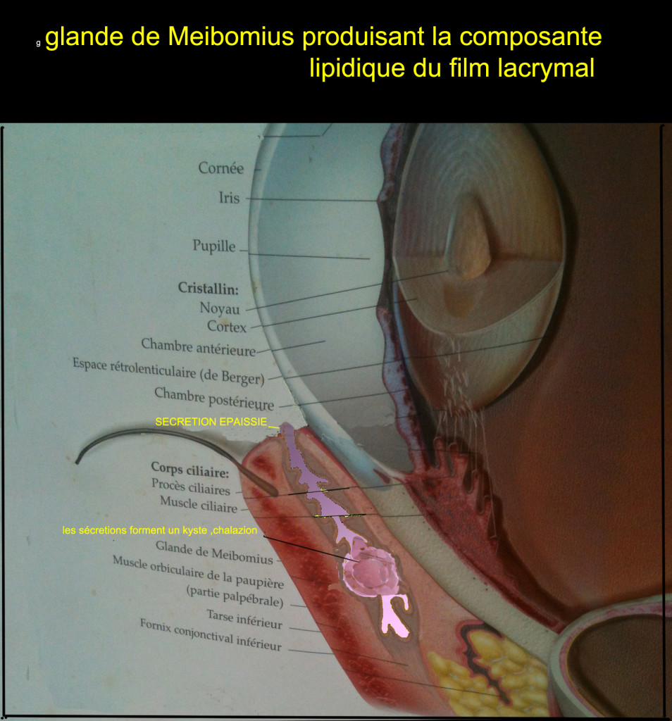 PAUPIERE INF MEIBOMITE FINI 2